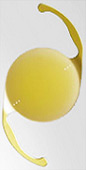 Toric Lens Implant for Astigmatism Correction